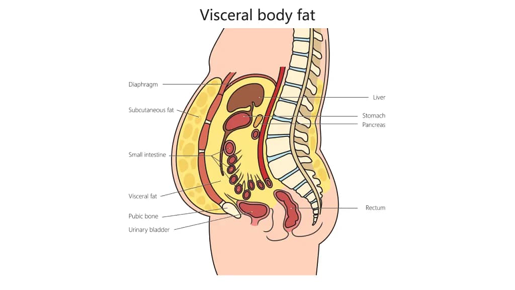 visceral fat