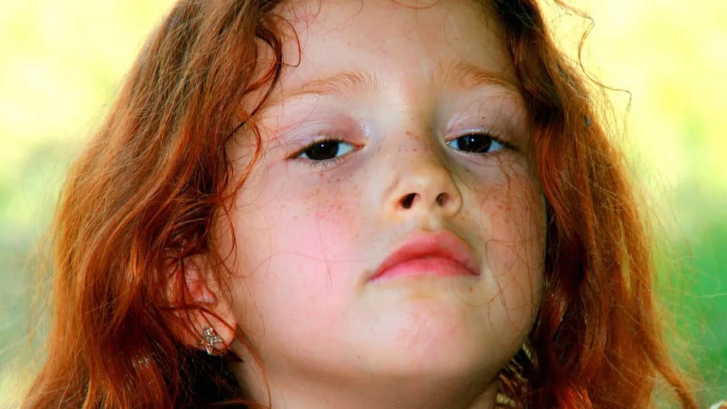Rosacea: Symptoms, Triggers, Treatment and What Really Helps