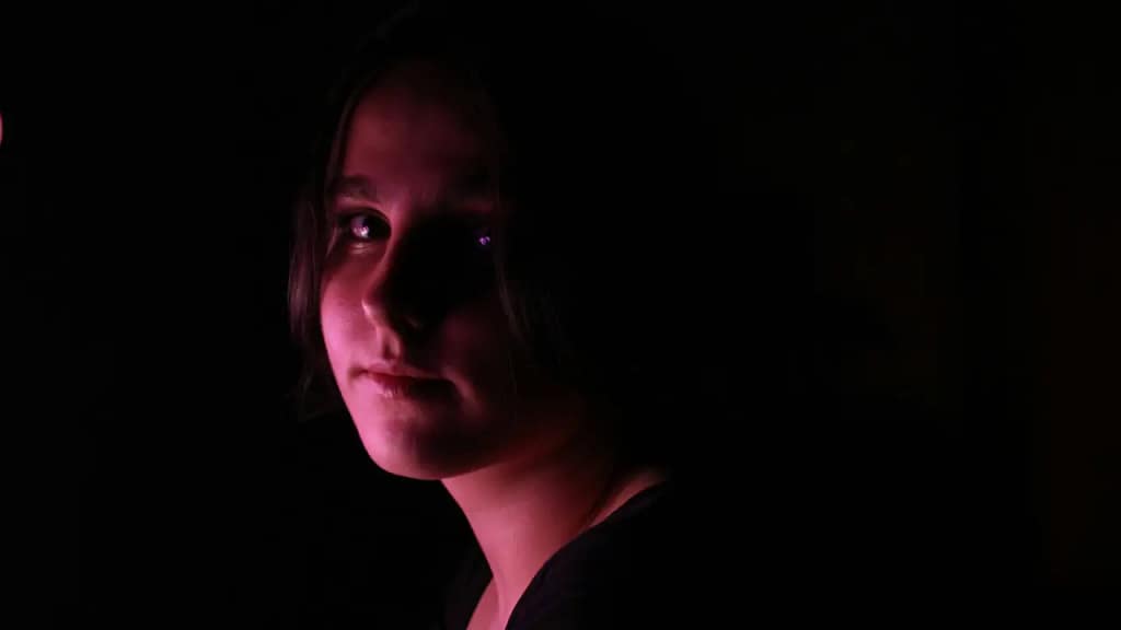 Young girl with facial redness associated with rosacea
