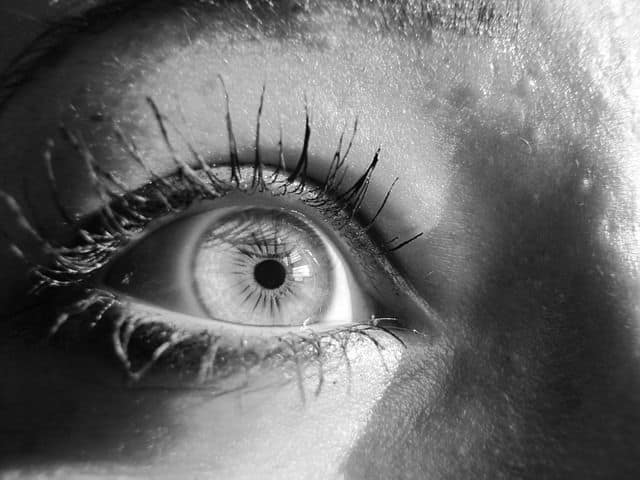 6 Natural Ways to Treat Rosacea and Redness