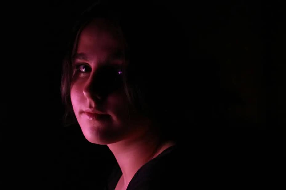 Young girl with facial redness associated with rosacea